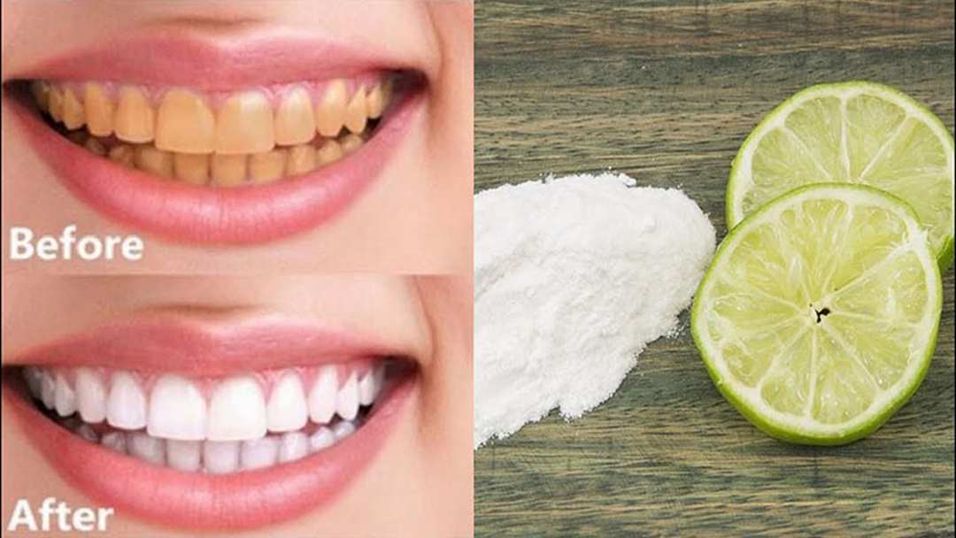 Sử dụng chanh để làm trắng răng an toàn.