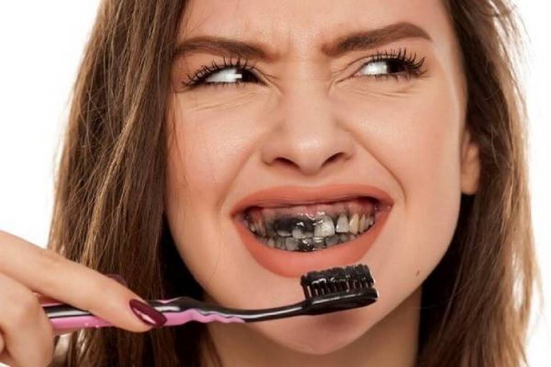 Cách làm trắng răng tại nhà bằng than hoạt tính